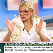 Ainhoa Arteta se sincera sobre las consecuencias de la amputación de sus dedos: «Tengo un dolor continuo»